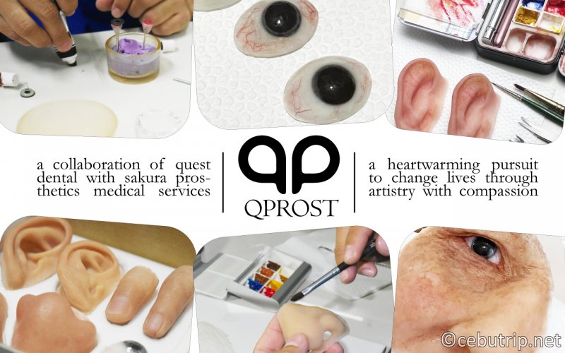 体の欠損に悩む人々の外見ケアに貢献するエピテーゼ「QPROST」